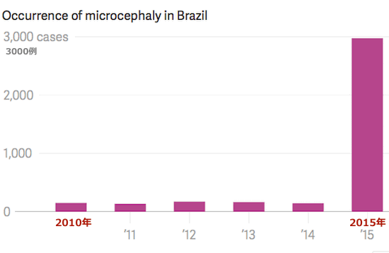 brazil-microcephaly-report