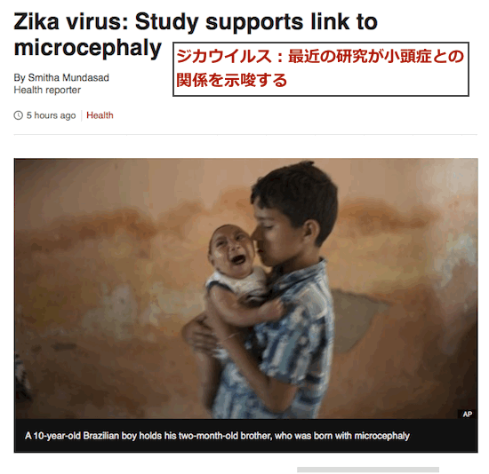 zika-microcephaly-link