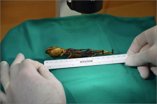 チリで発見された 長い頭蓋骨と奇妙な骨格を持つ全長15cmのヒューマノイド は ゲノムの全解析により７つの遺伝子変異を持つ人間の女の子だと判明 In Deep